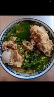 Hình ảnh Xương Ống 