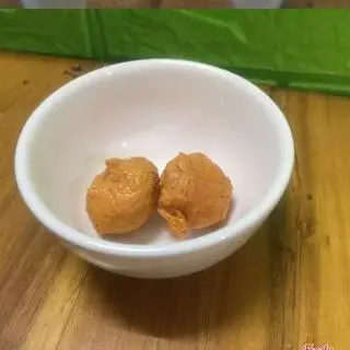 Hình ảnh mọc cua thêm 1 viên