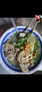 Hình ảnh hủ tiếu xương + hủ tiếu giò